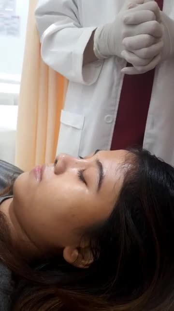 MŨI xinh "tỏa sáng" ngay trong quá trình cắt chỉ sau 7 ngày!