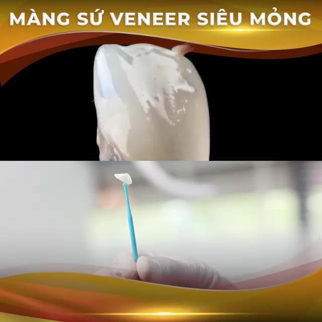 GIẢI MÃ CÔNG NGHỆ CHẤT LIỆU SỨ TẠI DELIA ??