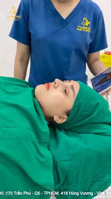 KHÁCH HÀNG NÂNG MŨI BÁN CẤU TRÚC SAU 60 PHÚT