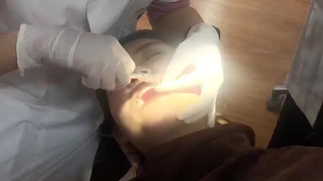 THÁO MẮC CÀI