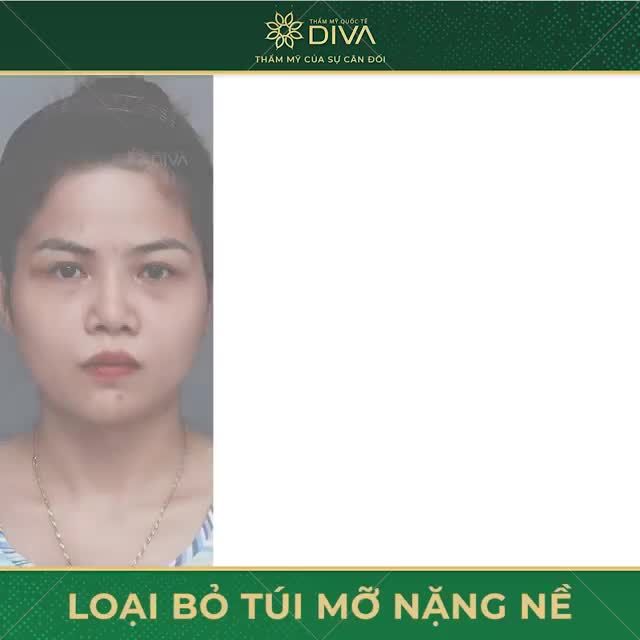 THAY ĐỔI THẦN THÁI NÂNG CẤP ÁNH NHÌN