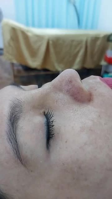 MŨI ĐẸP THANH TÚ BS KỲ Y DƯỢC