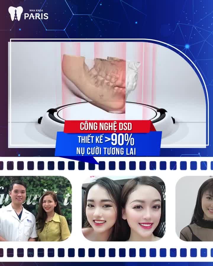 Răng sứ tự nhiên Càng cười càng đẹp