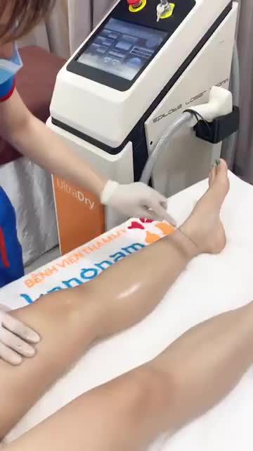 Sạch bóng lông chân với công nghệ Diode Laser