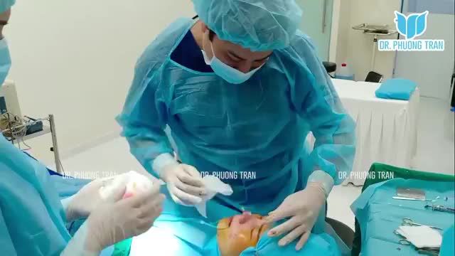Quá nhiều cảm xúc cho sự thay đổi này