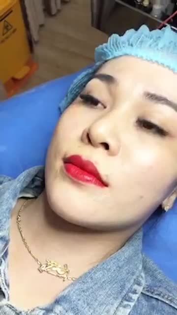 Quá trình phun môi xử lý thâm tại bệnh viện thẫm Mỹ Đông Á