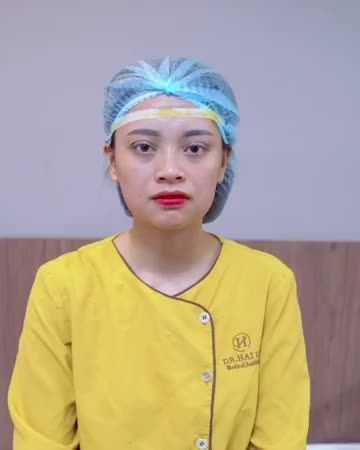 Thẩm mỹ mắt tại Dr.Hải Lê khẳng định: Mí đẹp không đau, ít sưng, bình phục nhanh, nếp mí đẹp tự nhiên rạng ngời!