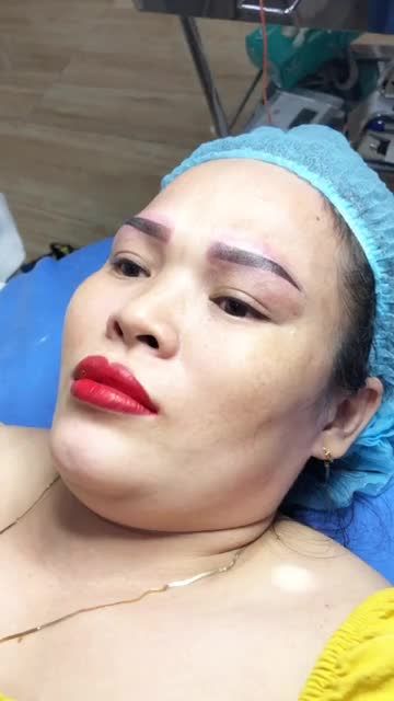Combo đón Tết phun xăm lông mày phun môi xử lý thâm cho khách hàng tại bệnh viện thẫm Mỹ Đông Á