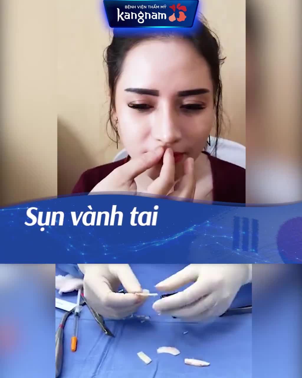 MŨI K-NOSE  đẹp mọi góc độ của khách yêu nhà Kangnam.