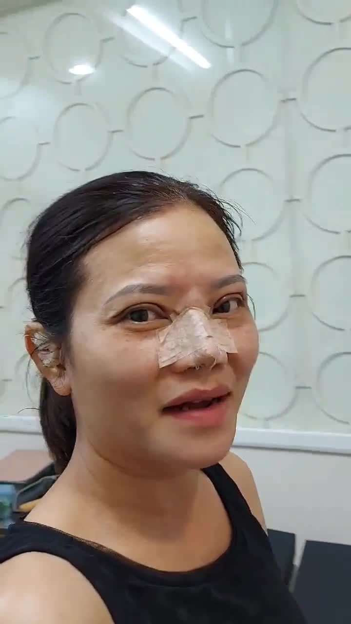 Combo nâng mui cắt mắt