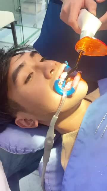 NIỀNG RĂNG Quyết định không thể đúng đắn hơn!
