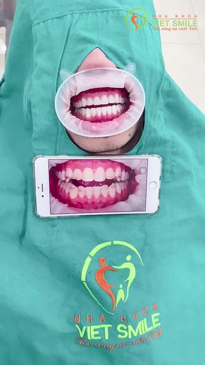 Siêu phẩm cuối ngày 23/12 để khách hàng kịp đón Giáng sinh