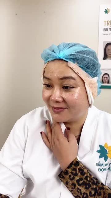 Kết quả trẻ hoá toàn diện Bio Lift