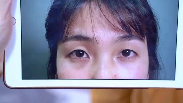 Video dành riêng cho những khách hàng đang sở hữu đôi mắt sụp mí u buồn, già nua... và mong muốn khắc phục nhược điểm để có 1 đôi mắt rạng rở tươi trẻ hơn!