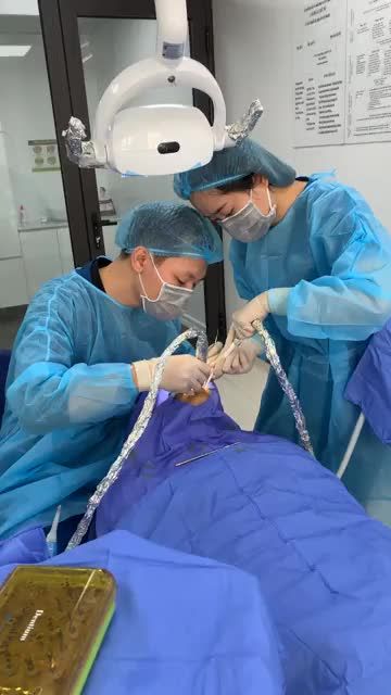 CẮM 01 TRỤ IMPLANT TẠI NHA KHOA PARIS QUẢNG NINH