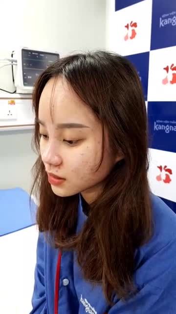 Nâng mũi cấu trúc Cải thiện gương mặt thon dài nhưng thiếu điểm nhấn