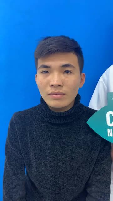 Kết quả chỉnh hình mắt cực khó do tai nạn của nam khách hàng sau 1 năm tại BVTM Đông Á