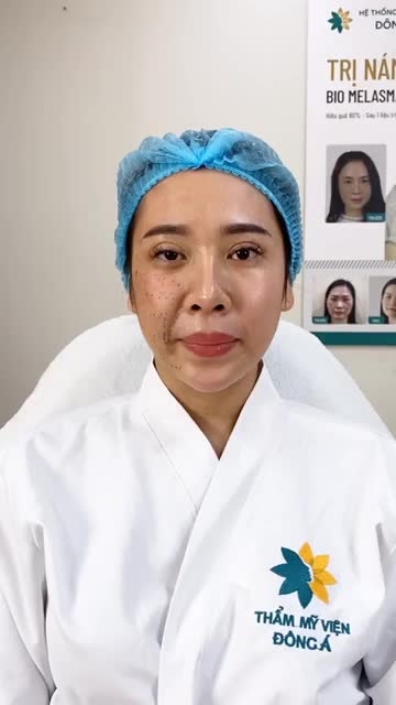 1/2 gương mặt mướt mịn căng bóng 1/2 còn lại vẫn xấu xí khô sạm, nhăn nheo Liệu pháp nào cho làn da TRẺ HOÁ TOÀN DIỆN?