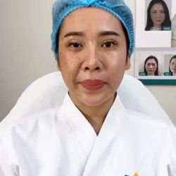 1/2 gương mặt mướt mịn căng bóng 1/2 còn lại vẫn xấu xí khô sạm, nhăn nheo Liệu pháp nào cho làn da TRẺ HOÁ TOÀN DIỆN?