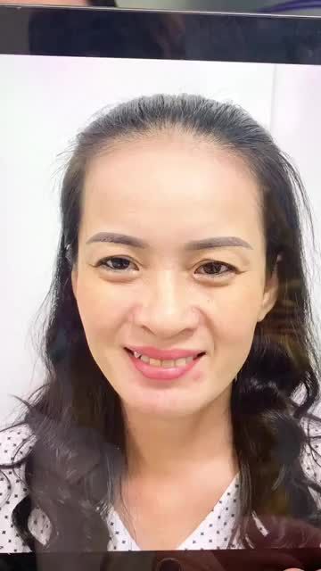 Cả gia đình không nhận ra được chị gái sau khi được NÂNG MŨI và CẮT MÍ tại Gangwhoo