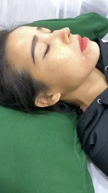 CA MŨI 10 NGÀY TẠI DR KHẢI