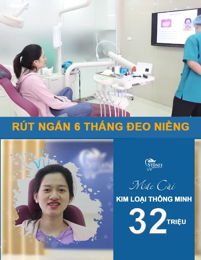 NIỀNG RĂNG KHÔNG ĂN ĐƯỢC GÌ ĐỒN HAY THẬT