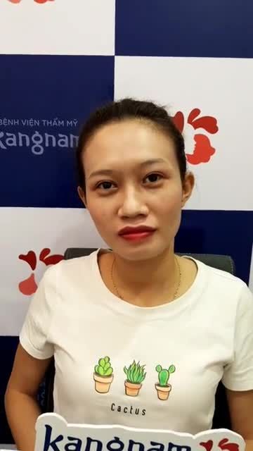Đôi mắt có hồn, đẹp tự nhiên hơn chỉ với combo chỉnh sụp mí tạo nếp mí ghép mỡ mí trên