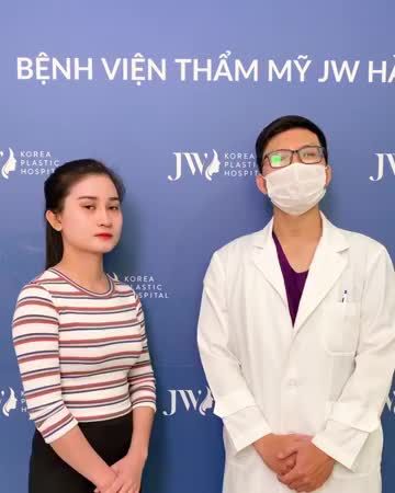 Đầu mũi thô, cánh mùi bè, sóng mũi không có và KẾT QUẢ BẤT NGỜ sau 7 ngày NÂNG MŨI S LINE