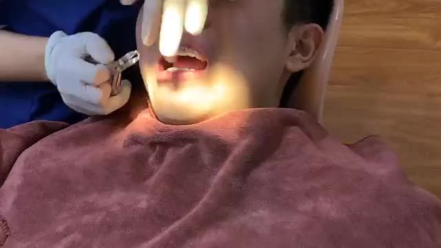 THÁO MẮC CÀI