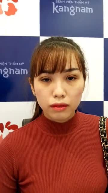 Thay đổi chỉ sau 7 ngày cắt mí