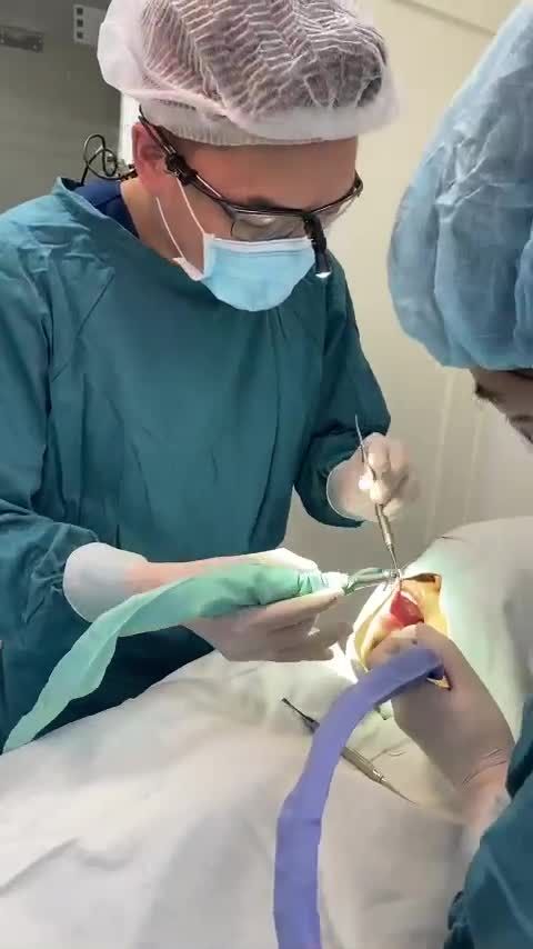 CẬN CẢNH QUY TÌNH CẤY GHÉP 2 TRỤ IMPLANT DENTIUM KOREA TẠI NHA KHOA PARIS 3/2
