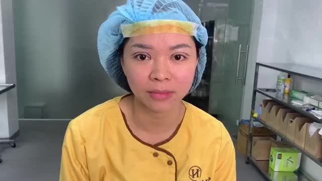 Mắt đẹp rạng rỡ, khuôn mặt trẻ ra rõ rệt chỉ có thể nhờ vào kỹ thuật Cắt mí tạo độ cong vểnh lông my tại Dr.Hải Lê