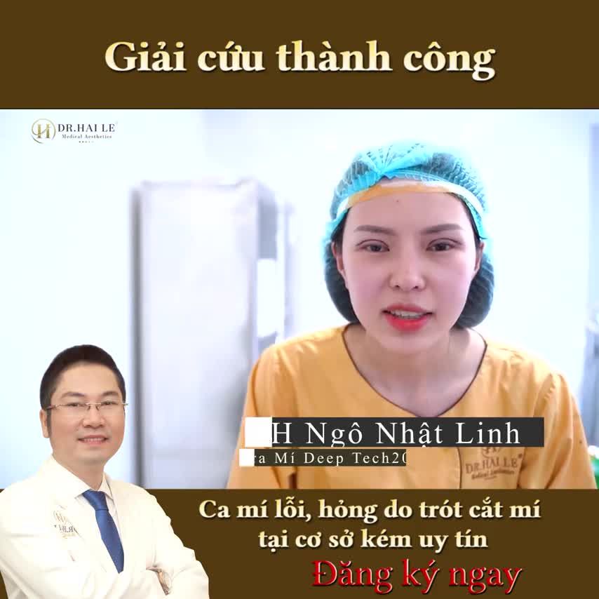 Khách hàng giải cứu mí hỏng bằng công nghệ Deep Tech 20 khoe nhân sắc rạng rỡ cùng biểu cảm ngất ngây khi thực hiện
