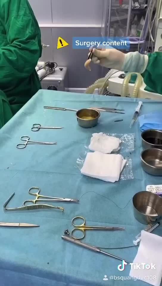 Ca combo độn cằm độn thái dương đầu tiên trong năm của bác sĩ. Bạn nào muốn biết kết quả thì Ib để được bác sĩ tư vẫn nhé.