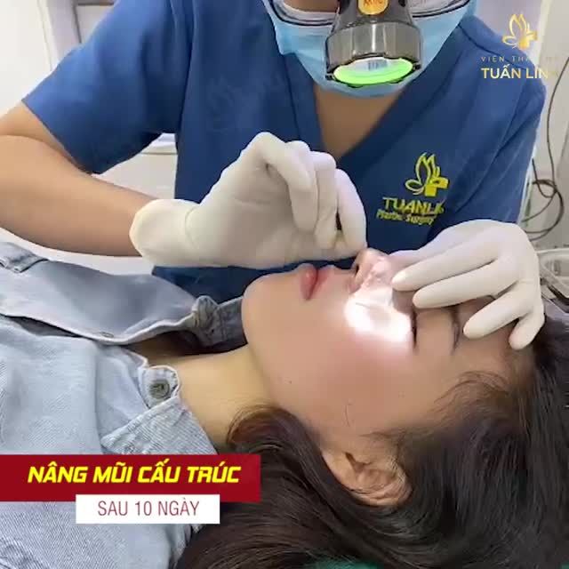 Chậm lại 1 phút ngắm mũi nhà em 1 chút thôi