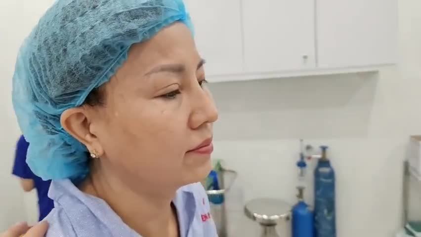CHỊ KHÁCH ĐỘN CẰM SAU KHI NÂNG MŨI 2 NĂM ƯNG Ý