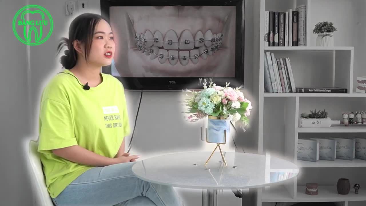 Niềng răng tăng 5 ký và những câu chuyện thú vị trong quá trình đeo niềng.