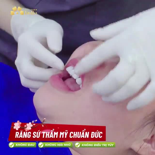 RĂNG XINH ĐÓN TẾT CÙNG VẠN ĐIỀU MAY