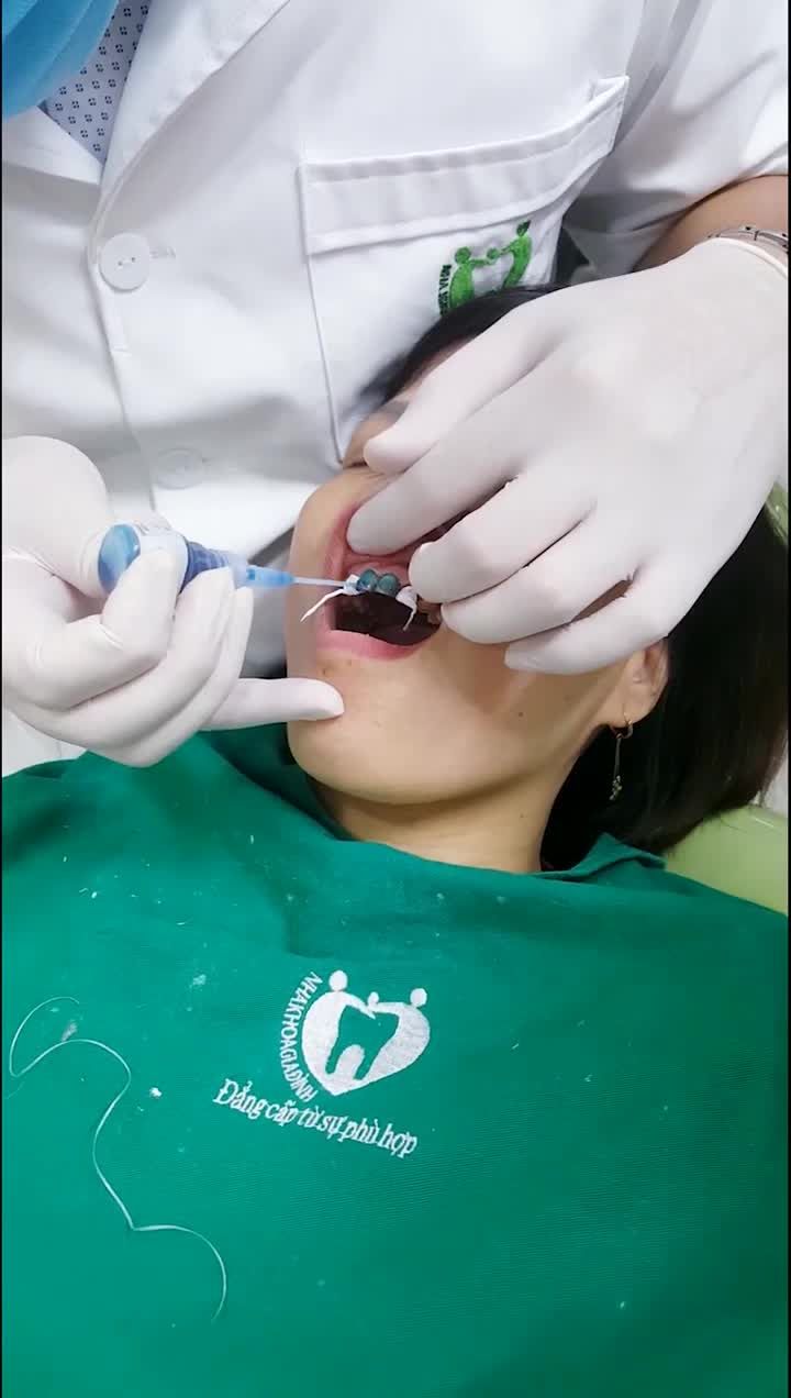 CÓ THẨM MỸ ĐƯỢC KHÔNG VỚI RĂNG NHIỄM MÀU KHÁNG SINH???