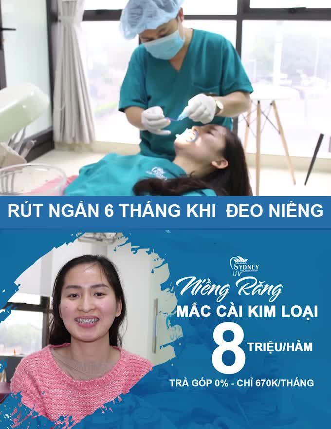 Niềng răng mắc cài kim loại được coi là giải pháp chỉnh nha tối ưu hiện nay bởi mang lại hiệu quả cao khi muốn khắc phục các khuyết điểm hô, móm, lệch lạc... do răng.
