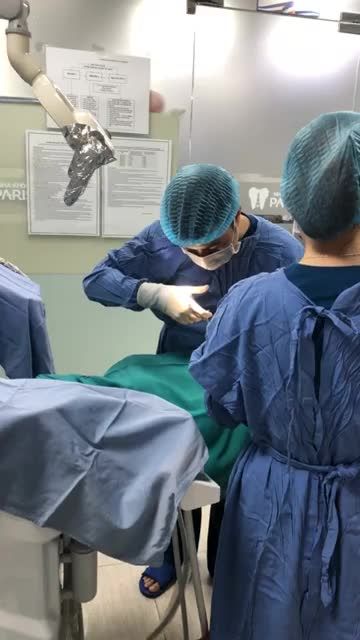 CẮM 01 TRỤ IMPLANT SIC THỤY SỸ TẠI NHA KHOA PARIS 12 THÁI THỊNH, HN.