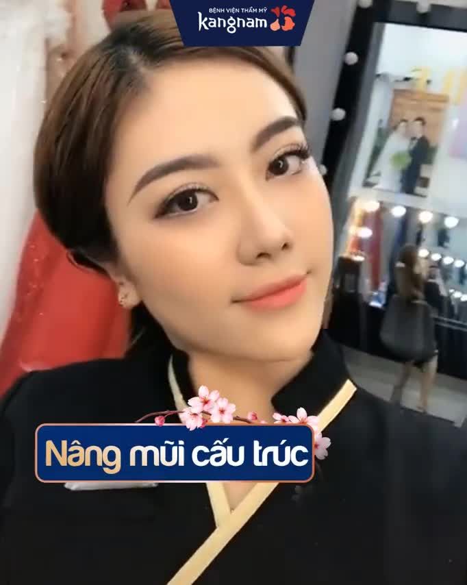 TUẦN CẬN TẾT NÂNG MŨI VẪN KỊP ĐẸP