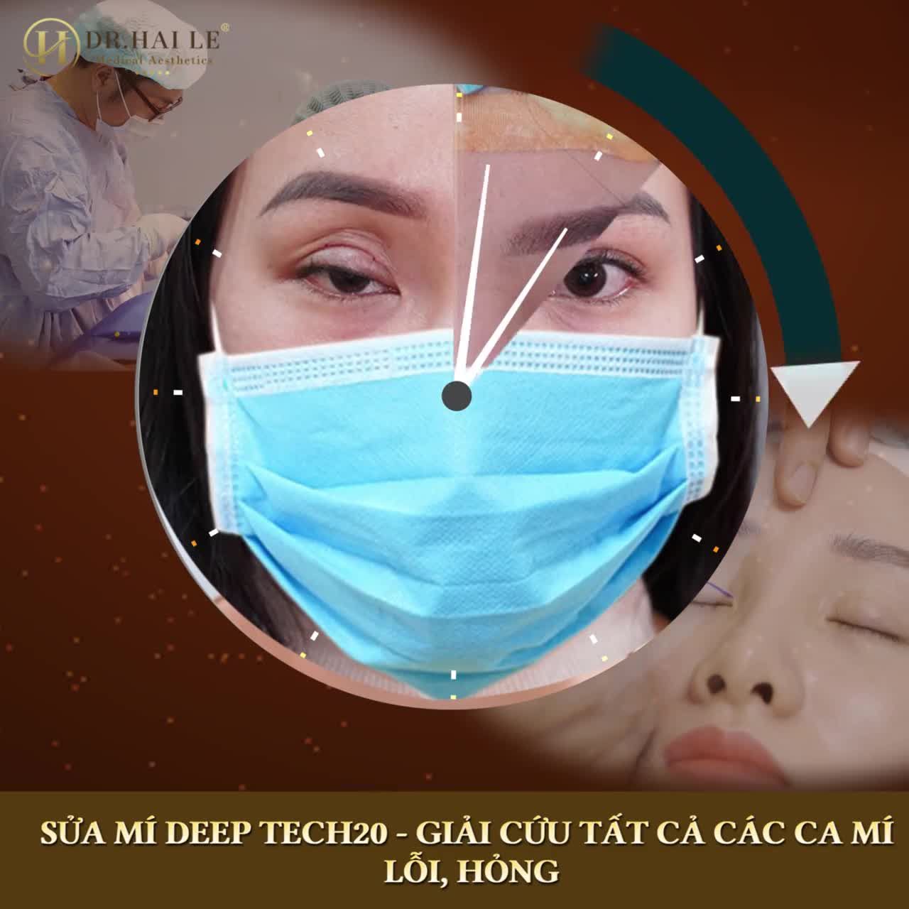 Tin tưởng SPA, tin tưởng NGƯỜI QUEN rồi tiếc nuối