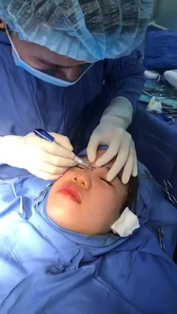 Thay đổi DÁNG MŨI đón Tết nguyên đán với Nâng mũi cấu trúc 4D Dịch vụ hot nhất Kangnam