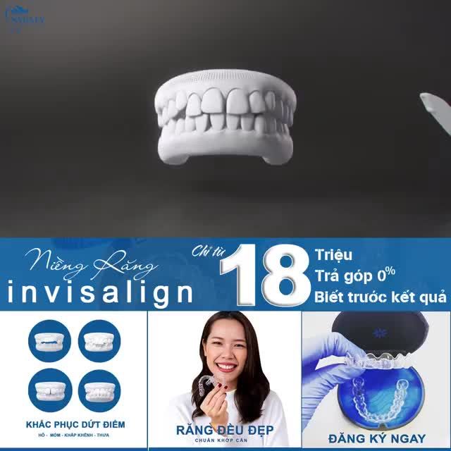 NIỀNG RĂNG TRẢ GÓP 0% LÃI SUẤT