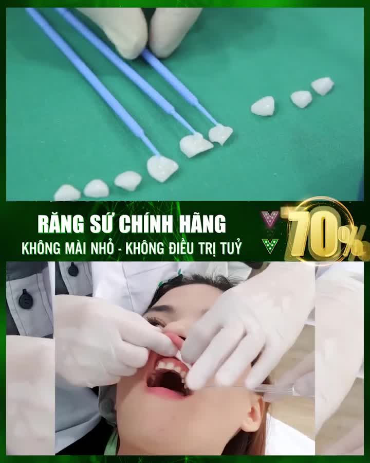 RĂNG TRẮNG TỰ NHIÊN RẠNG RỠ ĐÓN NĂM MỚI ️
