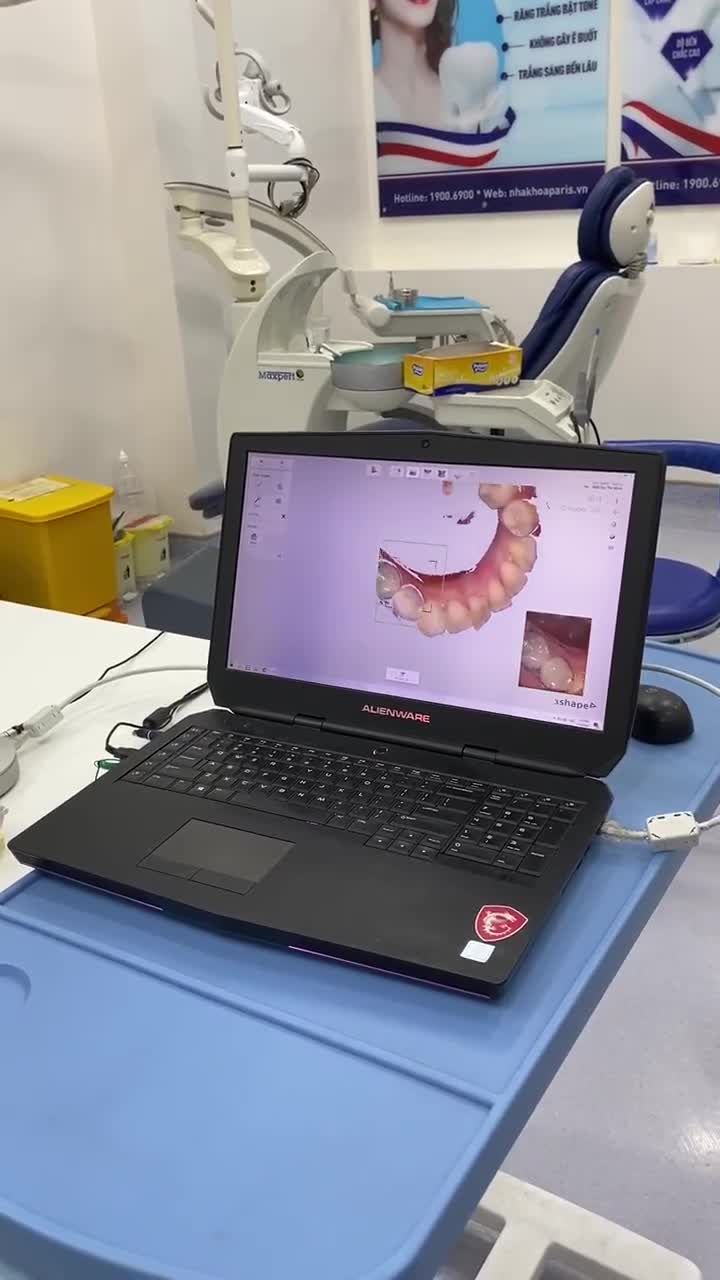 SCAN CHỈNH NHA KHAY TRONG INVISALIGN PARIS 87 NGUYỄN THÁI HỌC