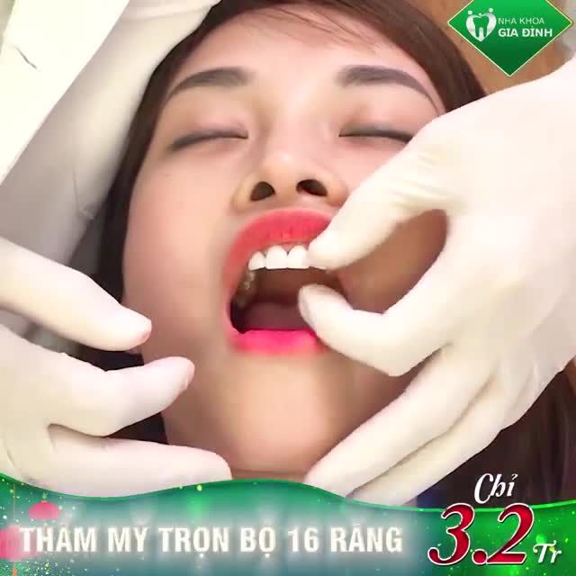 NỤ CƯỜI ĐẸP SANG TOẢ SÁNG TẾT NÀY ️