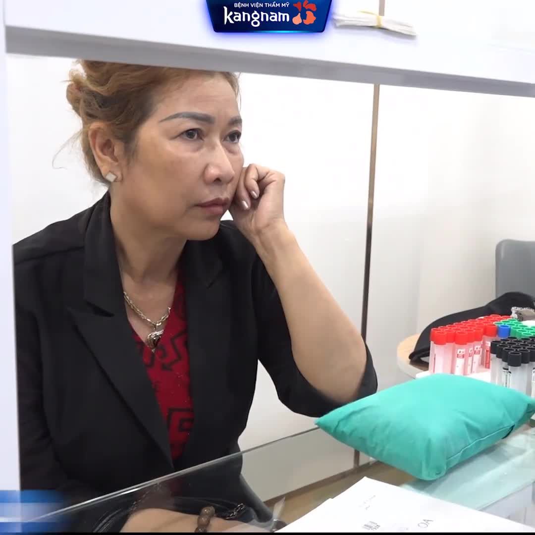Khách hàng 55 tuổi kéo lại thanh xuân với combo CẤY MỠ MẶT CĂNG DA ️