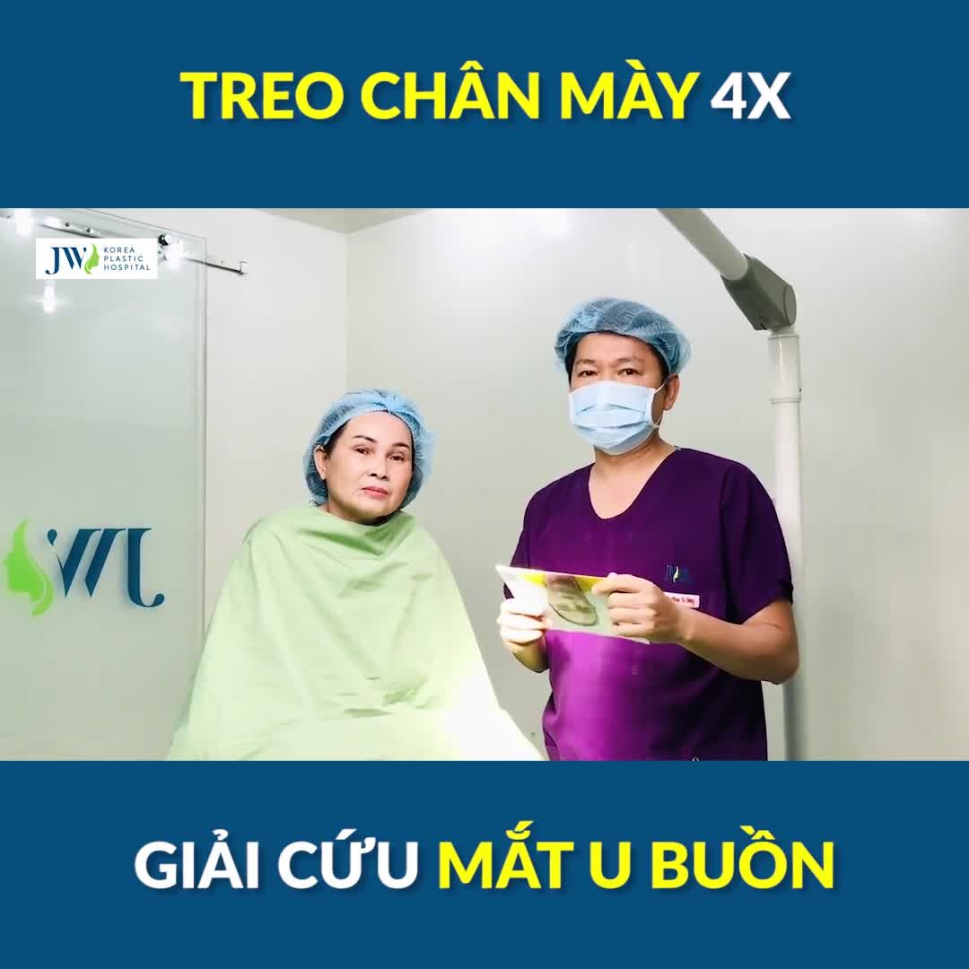 Bác sĩ Tú Dung GIẢI CỨU đôi mắt U BUỒN, mi SỤP HOÀN TOÀN hóa 2 mí TRẺ TRUNG